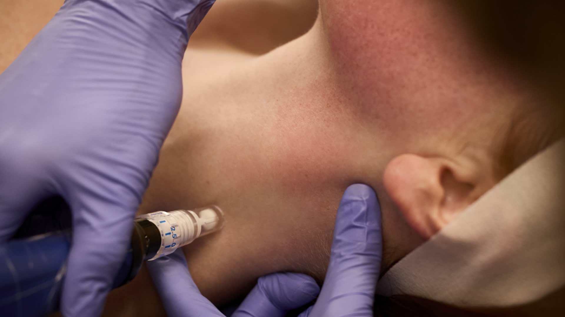 Smooth the appearance of <em>wrinkles</em> on the neck